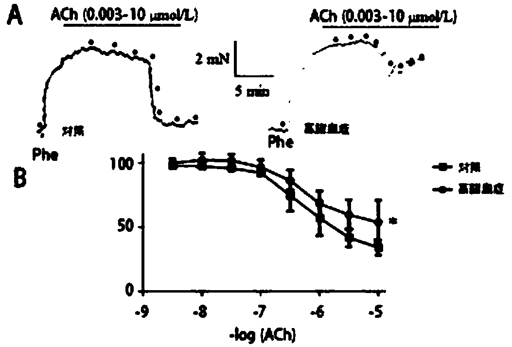 Vascular endothelial cell PINK1 acetylation inhibitor and application thereof