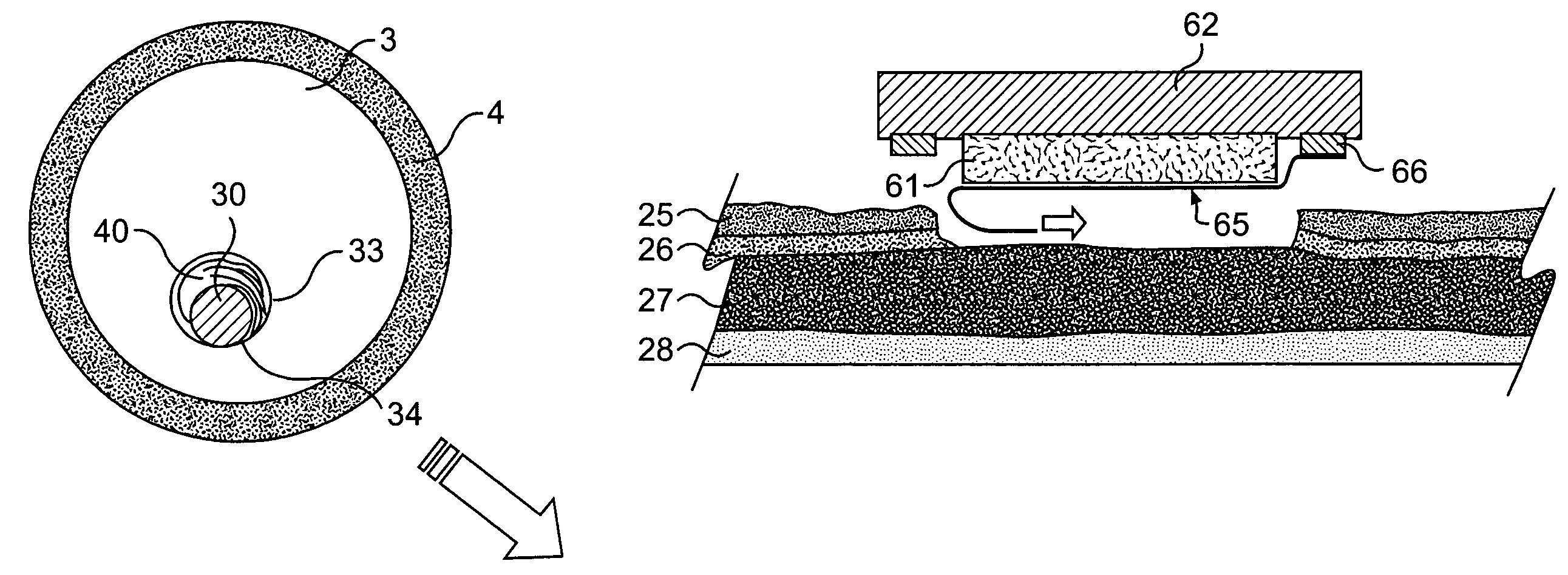 Tissue patches and related delivery systems and methods