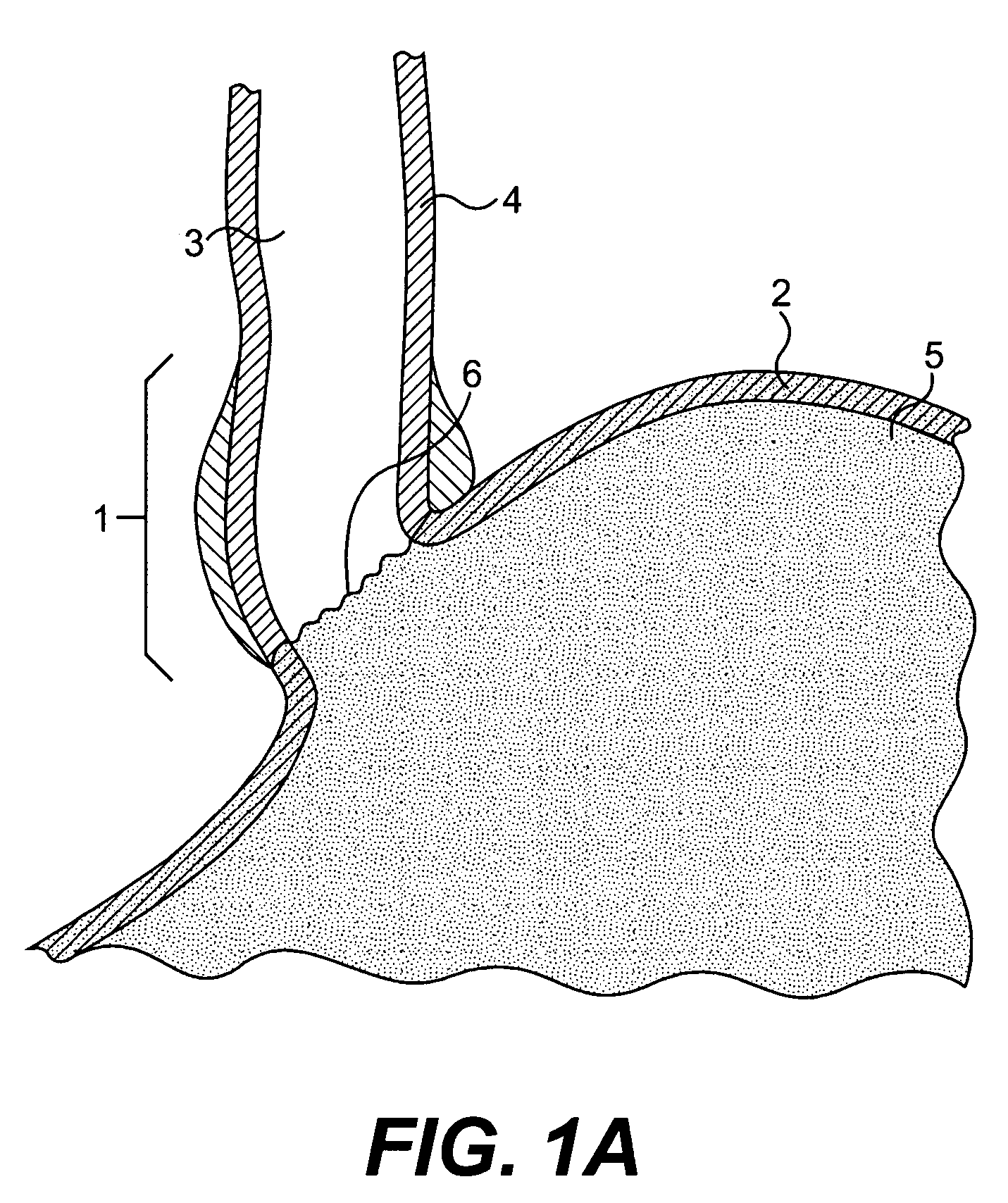 Tissue patches and related delivery systems and methods