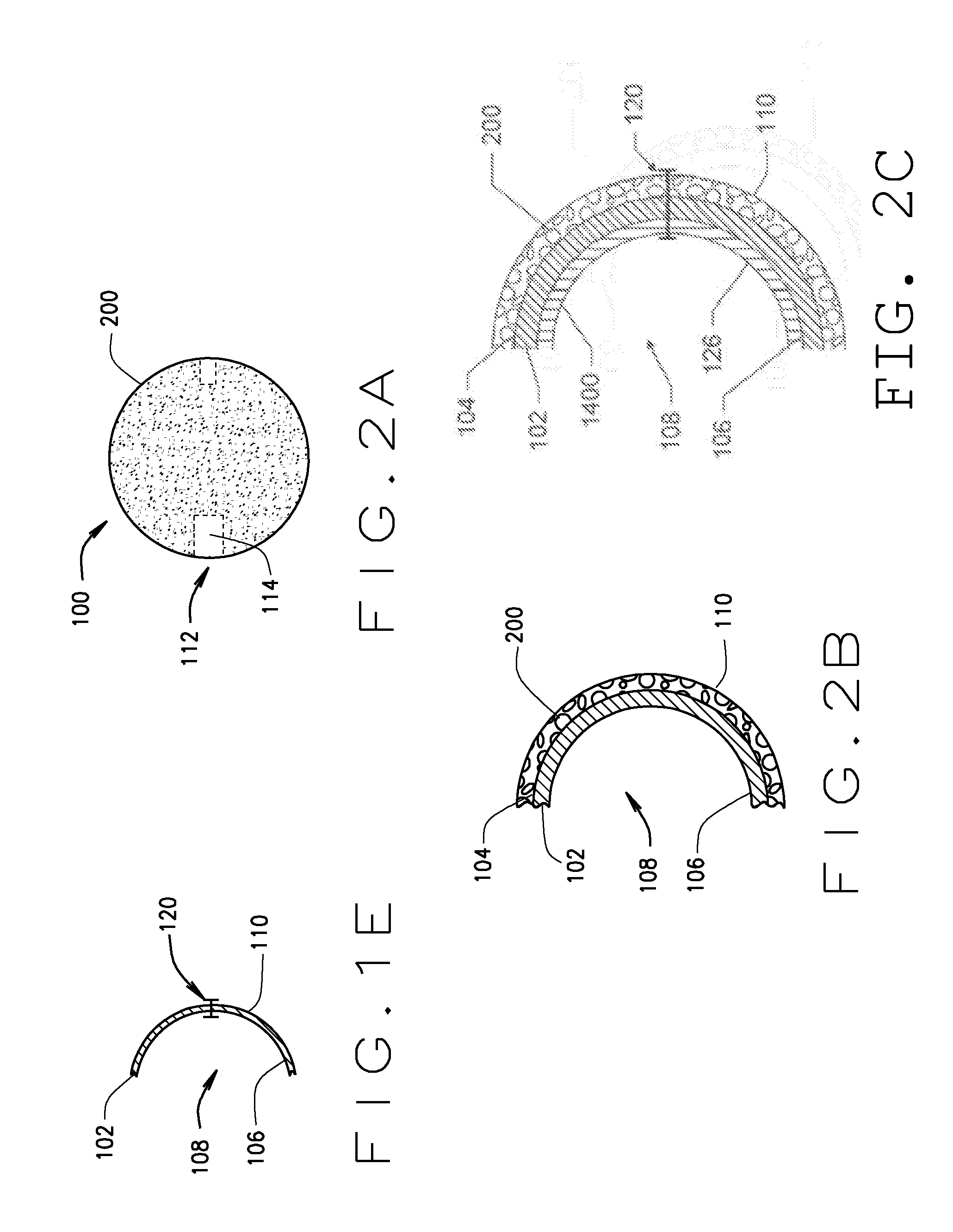 Detachable metal balloon delivery device and method
