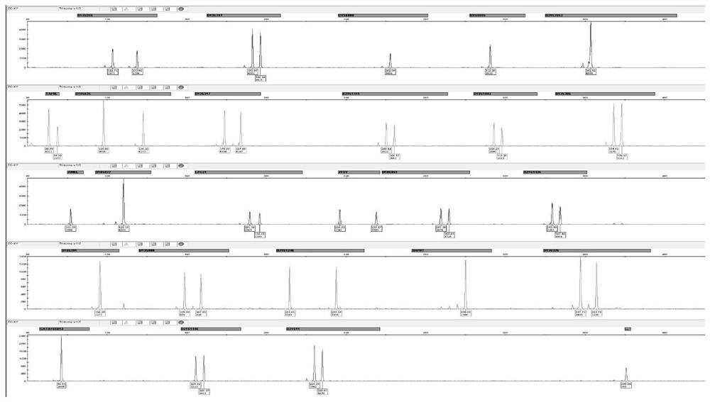 Amplification composition with abnormal number of chromosomal aneuploidy and application thereof