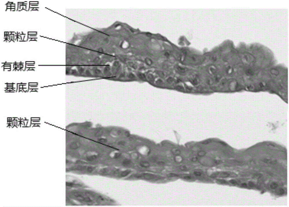 Culture method for acquisition of tissue-engineered epidermis and application of culture method