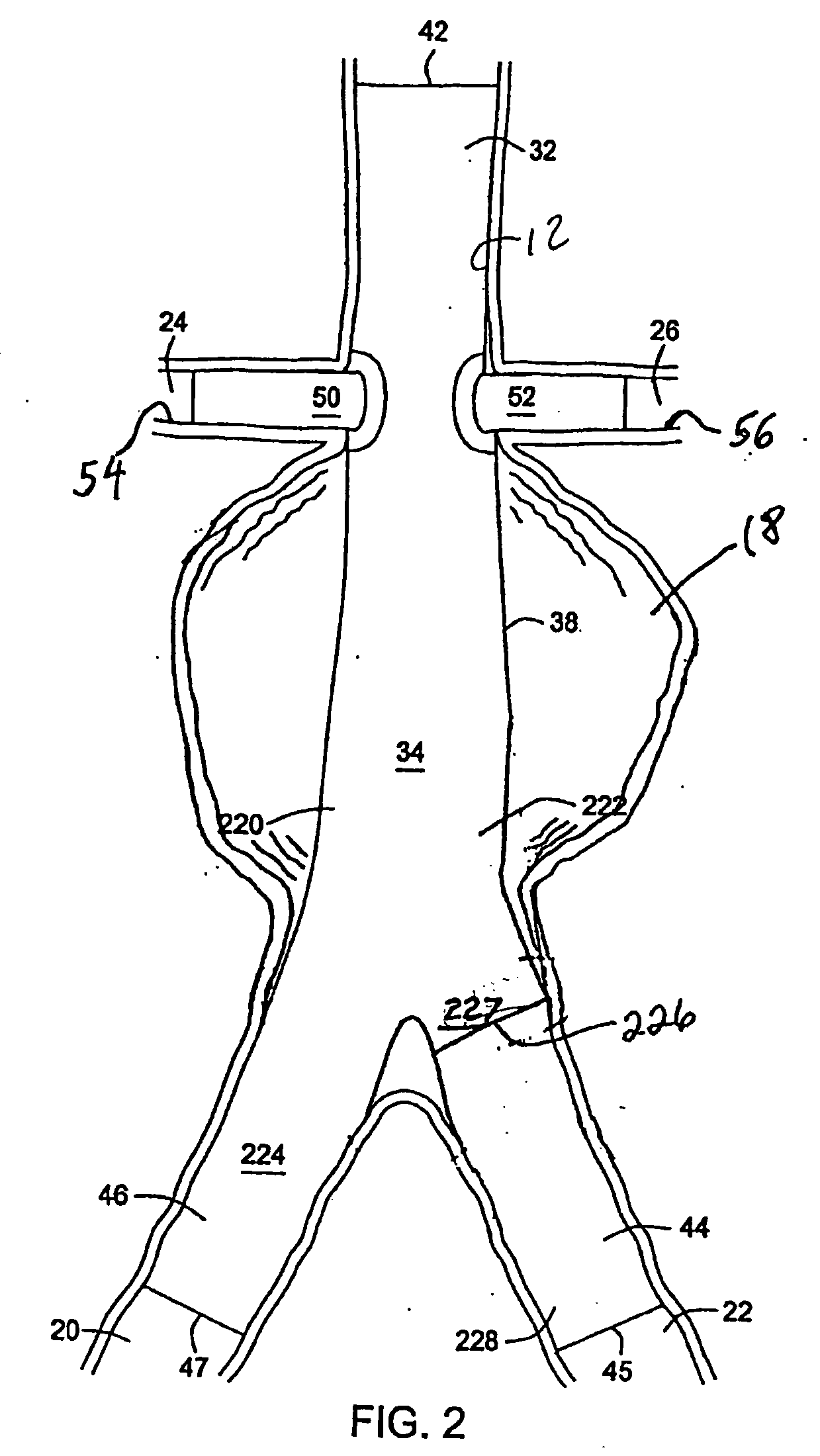 Methods and apparatus for treatment of aneurysms adjacent branch arteries including branch artery flow lumen alignment