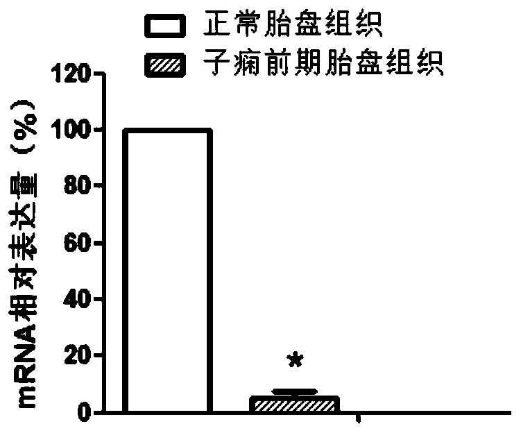 hcst gene as a target for diagnosis and treatment of preeclampsia