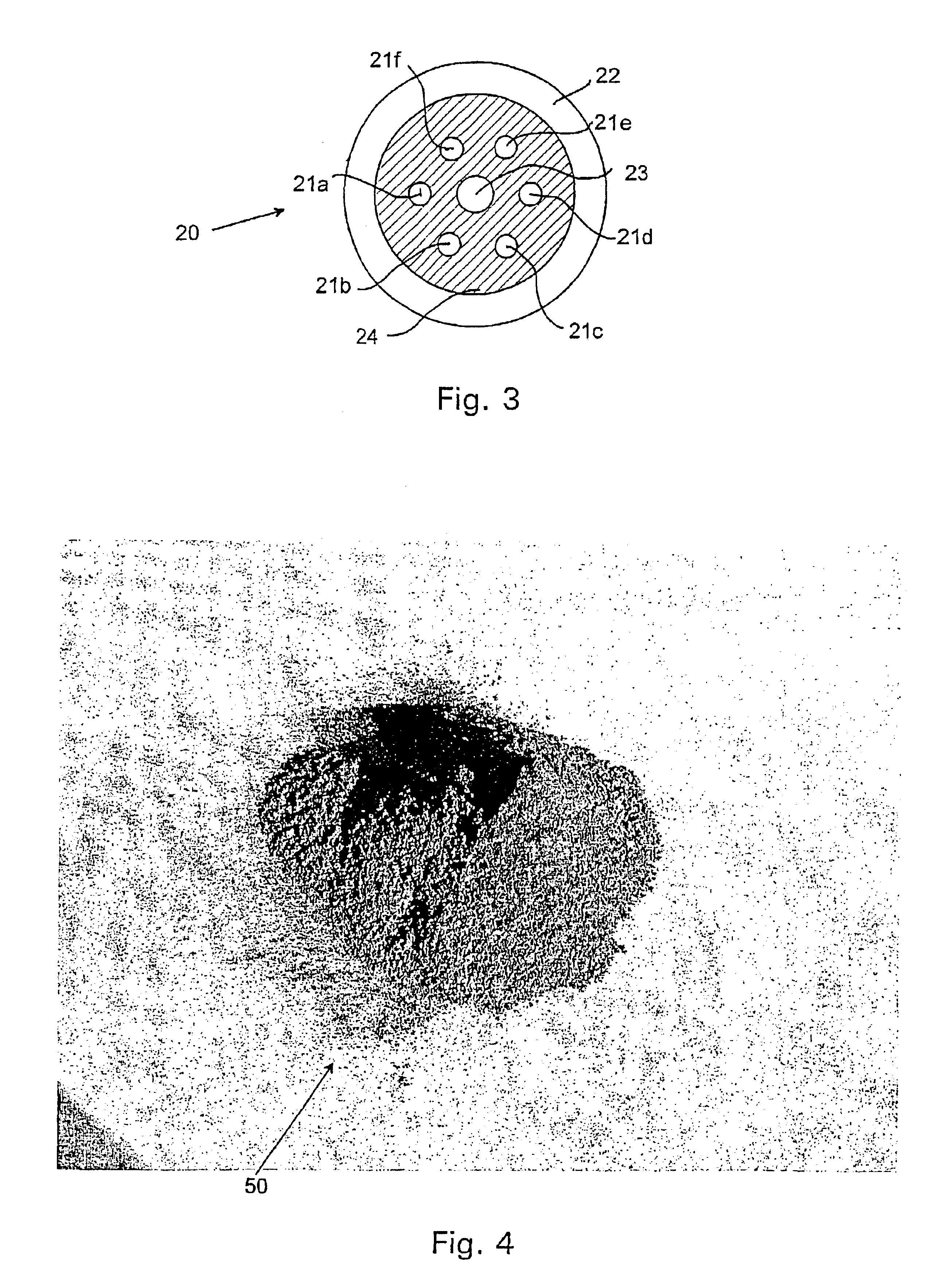 Method and an apparatus for recovery of metals