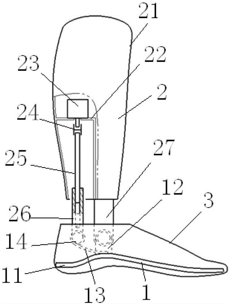 Powered below-knee prosthesis