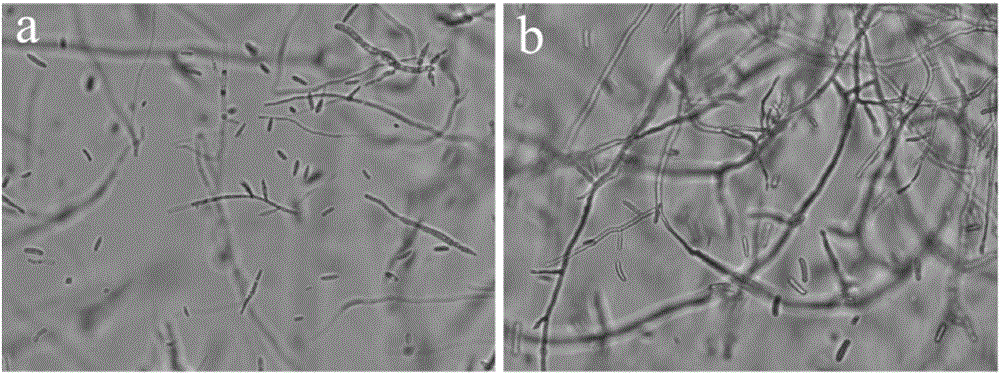 Quick separation and detection method of fusarium in sample and culture medium used by method