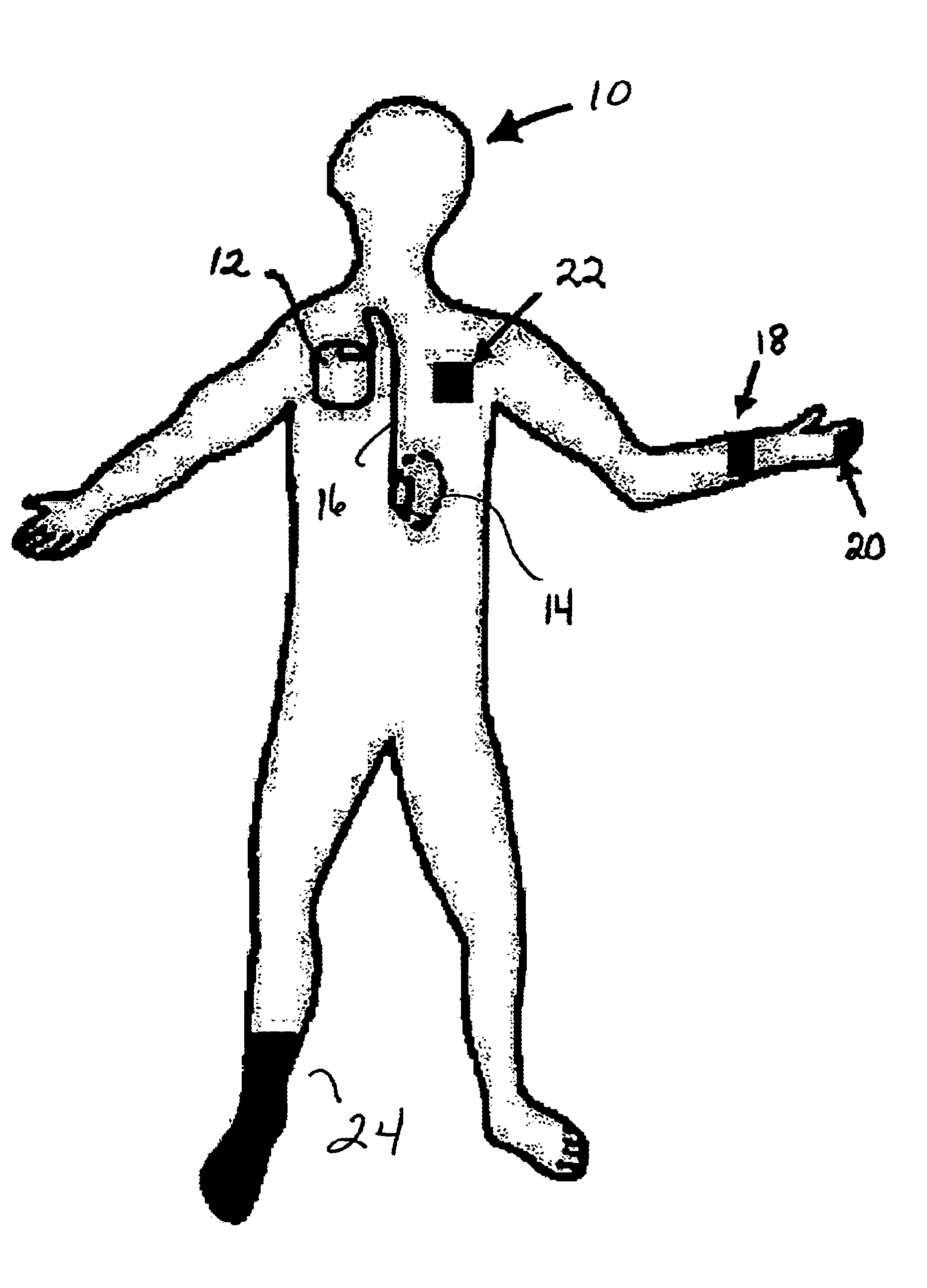 Implantable medical device controlled by a non-invasive physiological data measurement device
