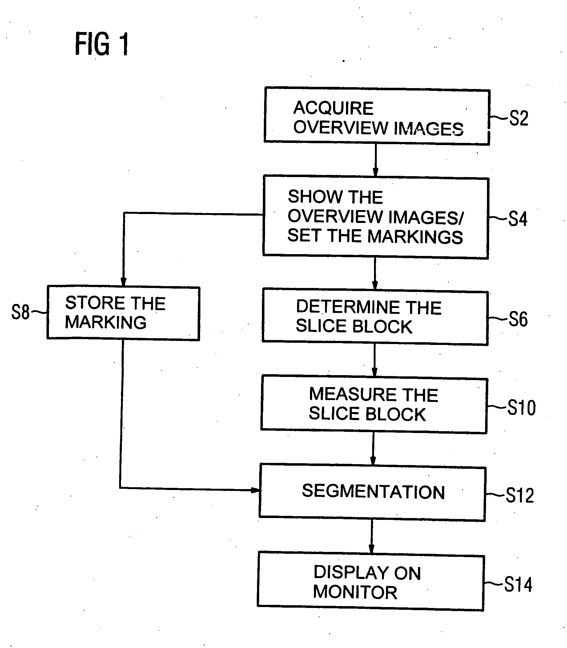 Method for segmenting a medical data set