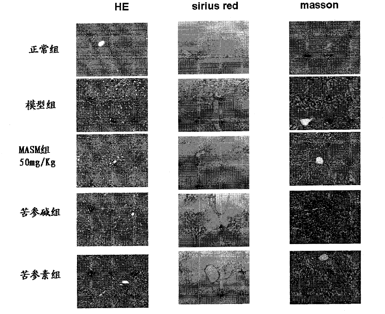 Application of 13-methylamino-18-thiomatrine compound in the preparation of anti-hepatic fibrosis or other tissue and organ fibrosis drugs