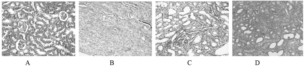 Bunge auriculate root extractive for preventing renal fibrosis