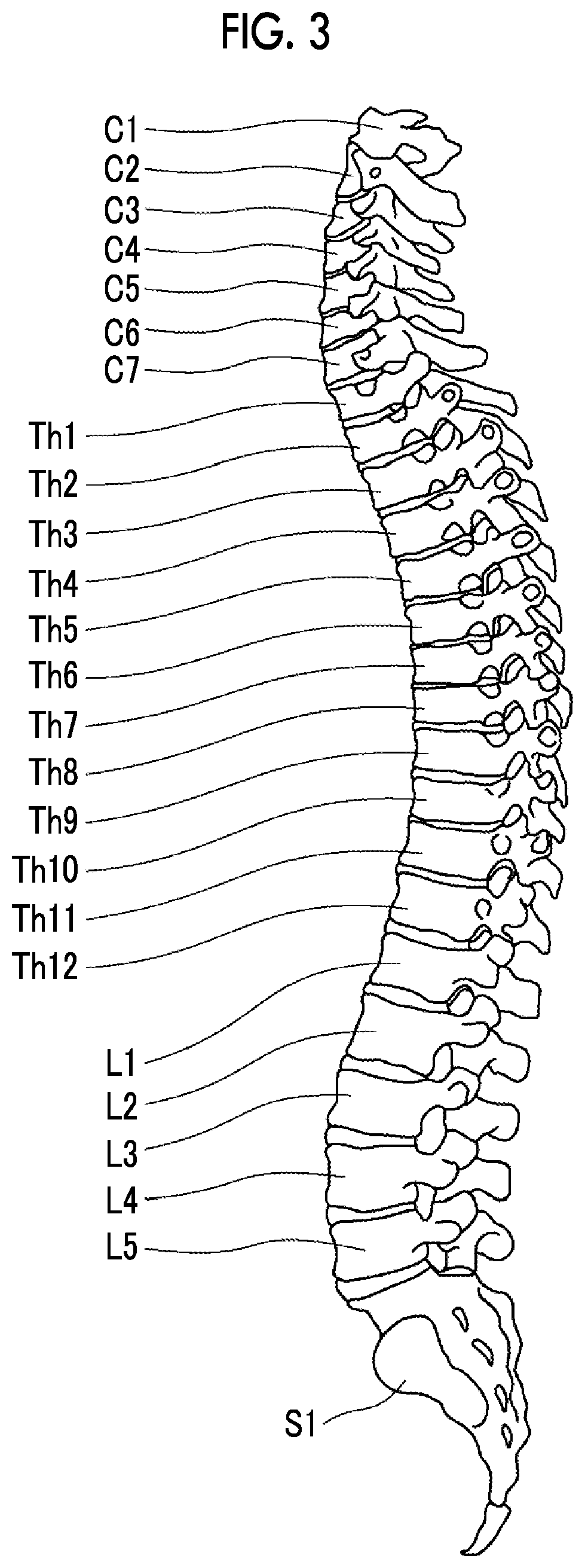 Structure separating apparatus, structure separating method, and structure separating program, learning device, learning method, and learning program, and learned model