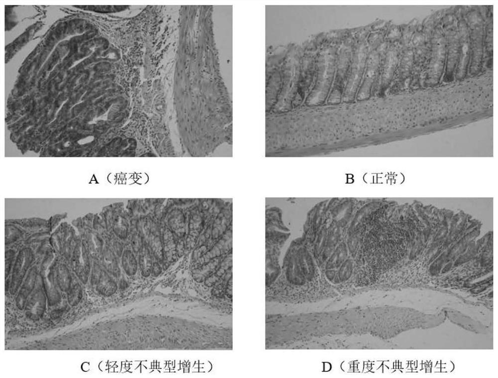 Application of traditional Chinese medicine composition in preparation of medicine for preventing colorectal cancer