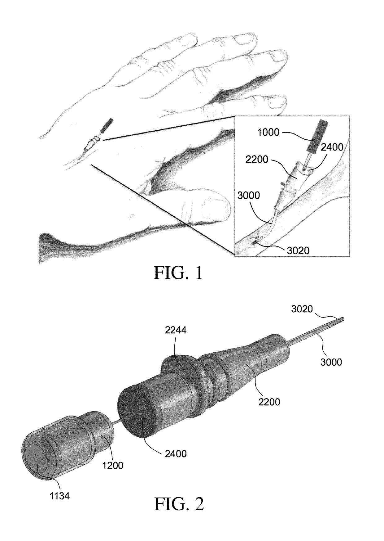 Directing hub used with vascular blood sampling catheter