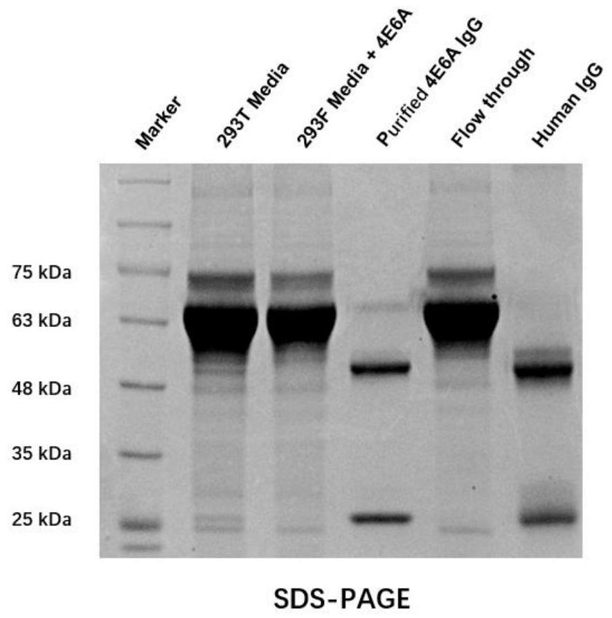 A human-mouse chimeric anti-Siglec-15 full-molecule IgG with neutralizing effect and its preparation method and application