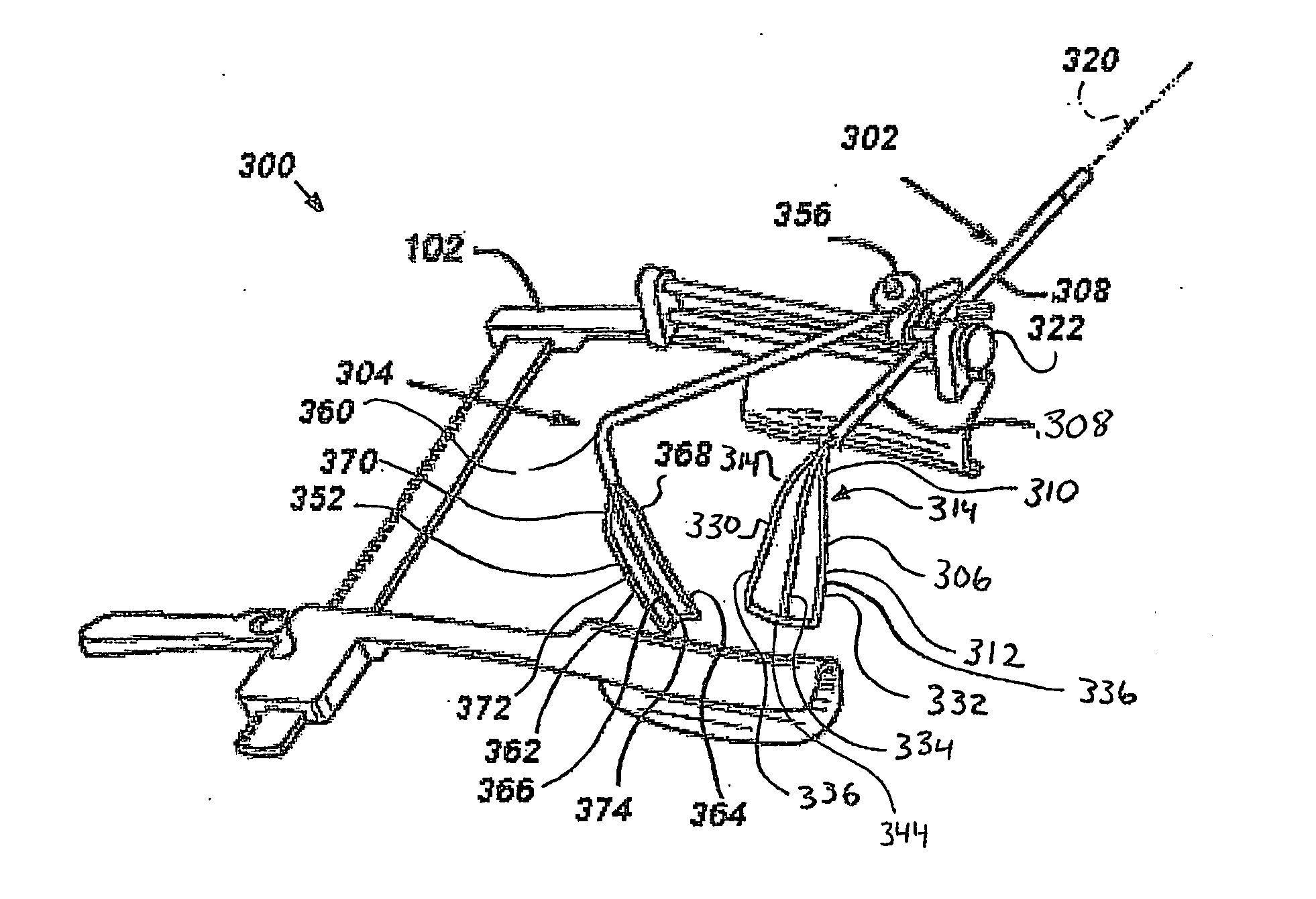 Sugical retractors and method of operation