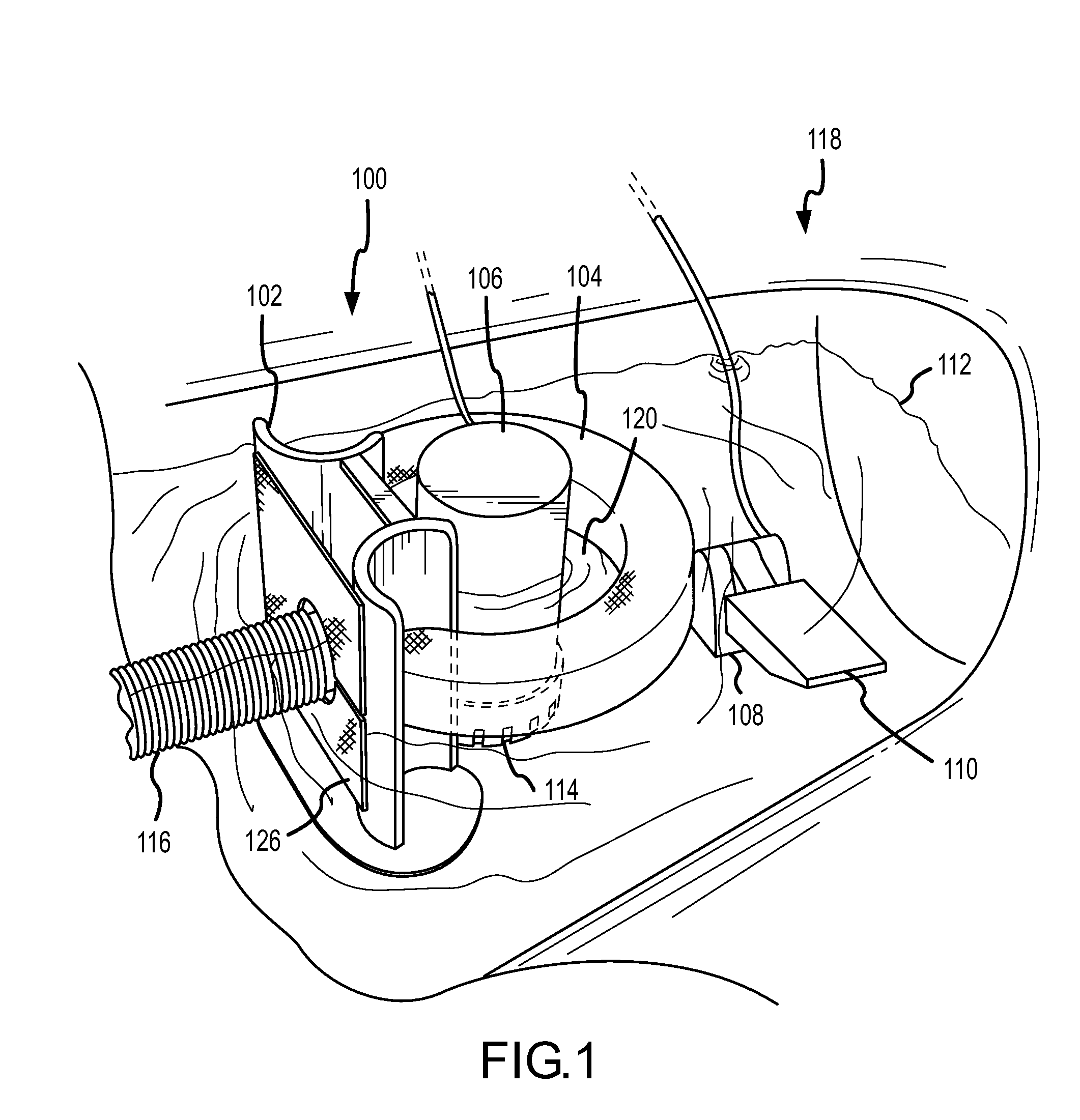 Water pollution prevention and remediation apparatus