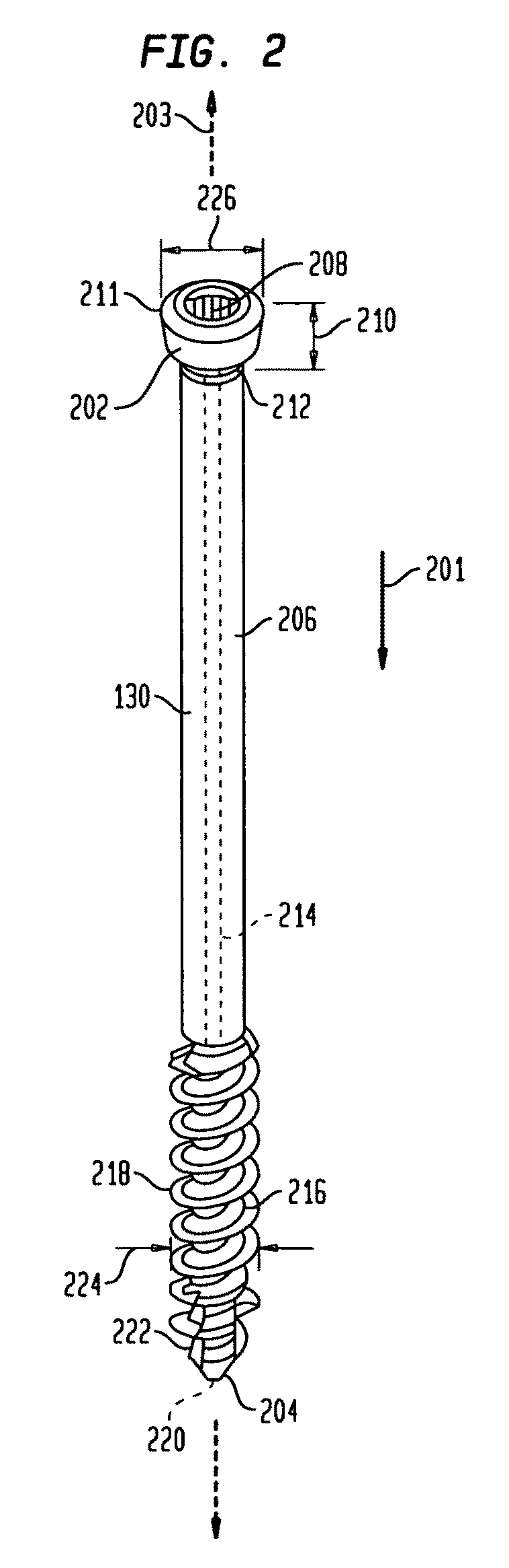 Intramedullary fixation assembly and method of use