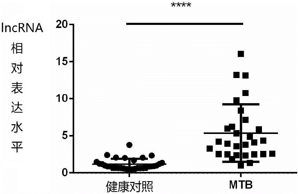 Applications of lncRNA-MIR3945HG V2 in diagnosis of mycobacterium tuberculosis negative pulmonary tuberculosis