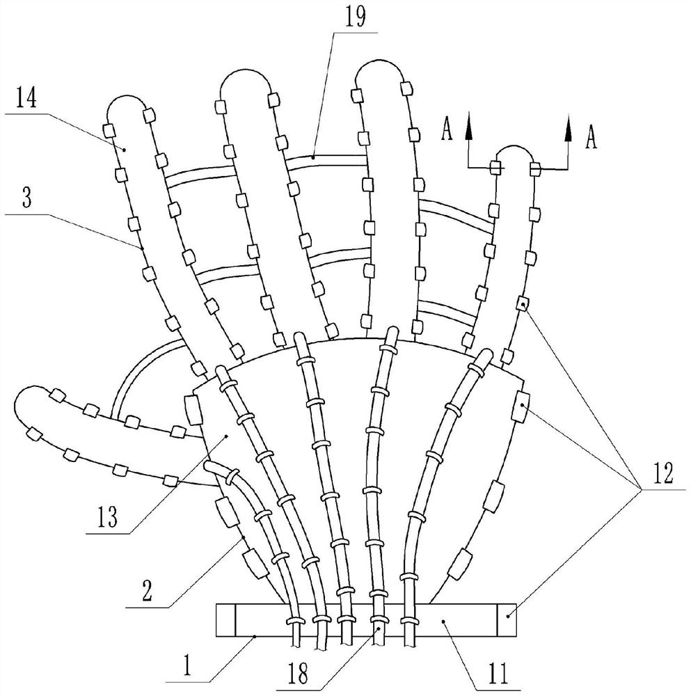 Comprehensive treatment and rehabilitation device for hand burn