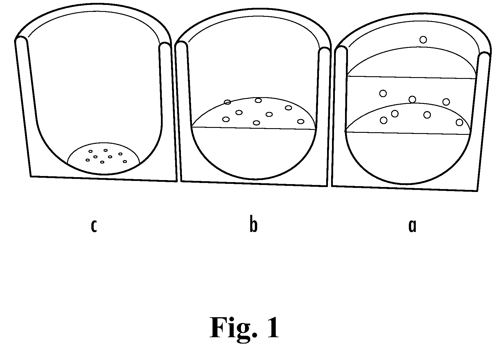 Loadable Polymeric Microparticles for Therapeutic Use in Alopecia and Methods of Preparing and Using the Same