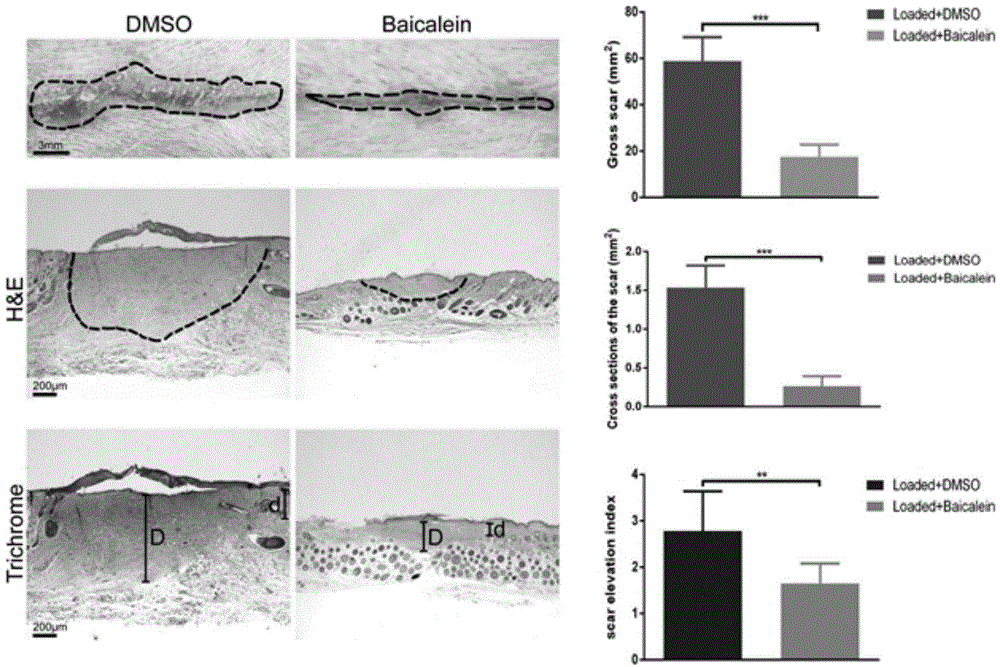 Application of flavonoids compound baicalein in skin cicatrisation inhibition