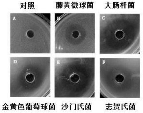 Lactobacillus plantarum with bacteriostat characteristic and application thereof in diarrhea prevention