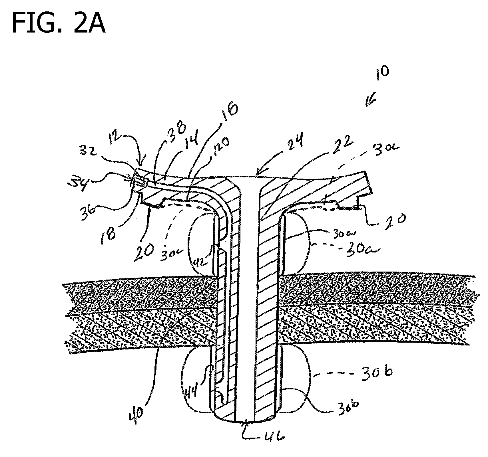 Skin level device for use with gastrostomy tube