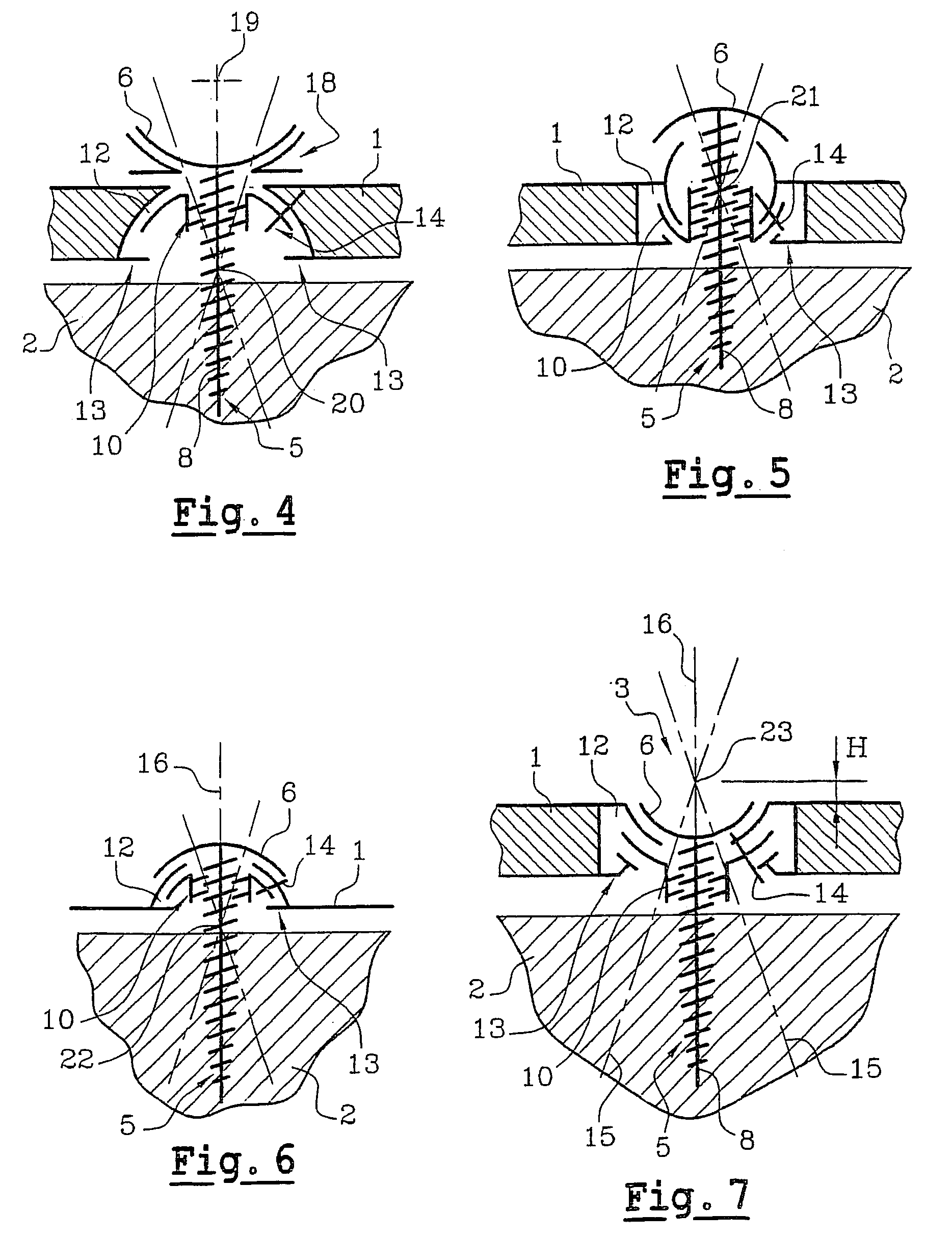 Orthopedic implant consisting of a support structure provided with at least an orifice for passing through a fixing screw associated with a nut