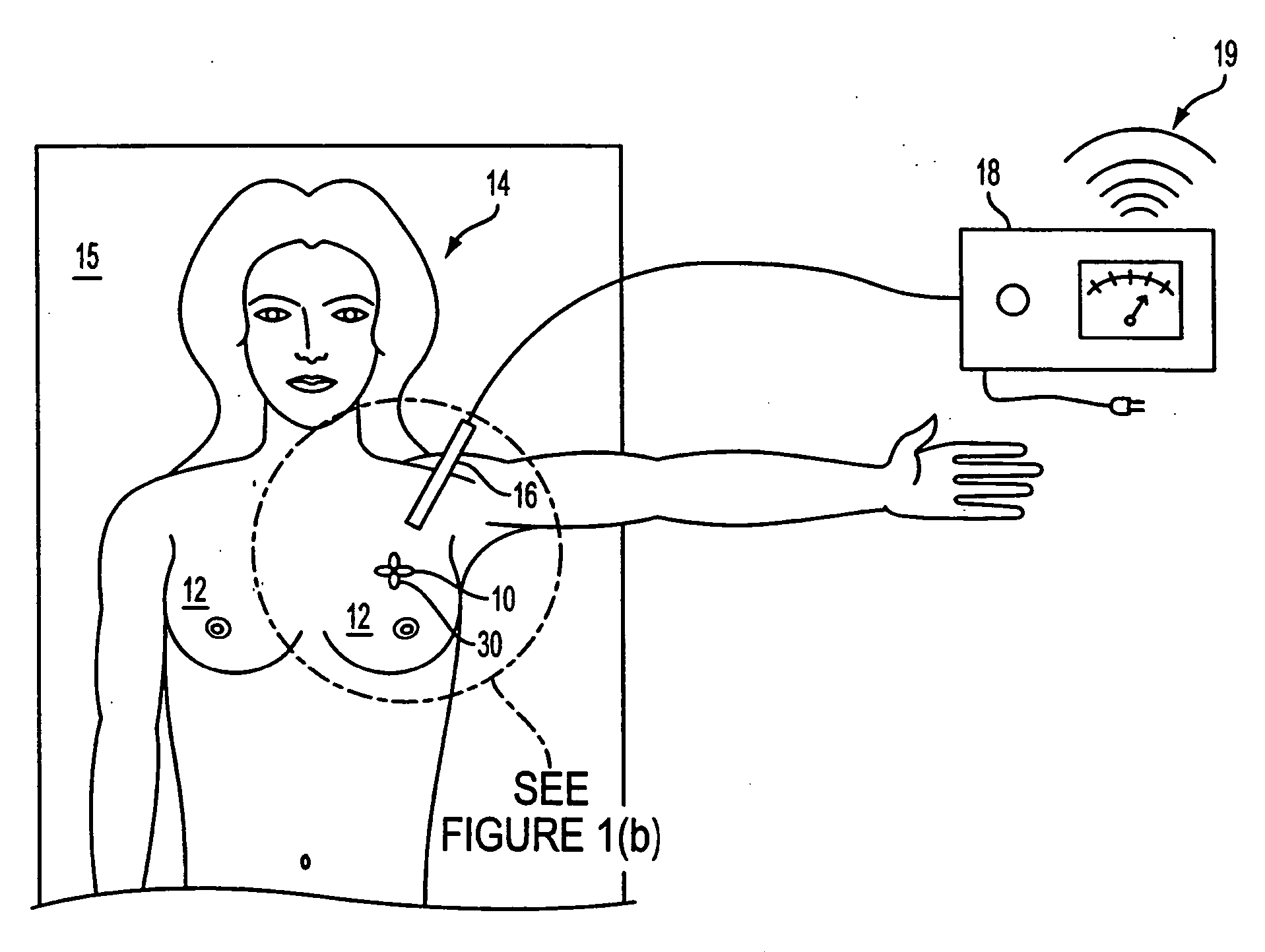 Tissue Marking Devices and Systems
