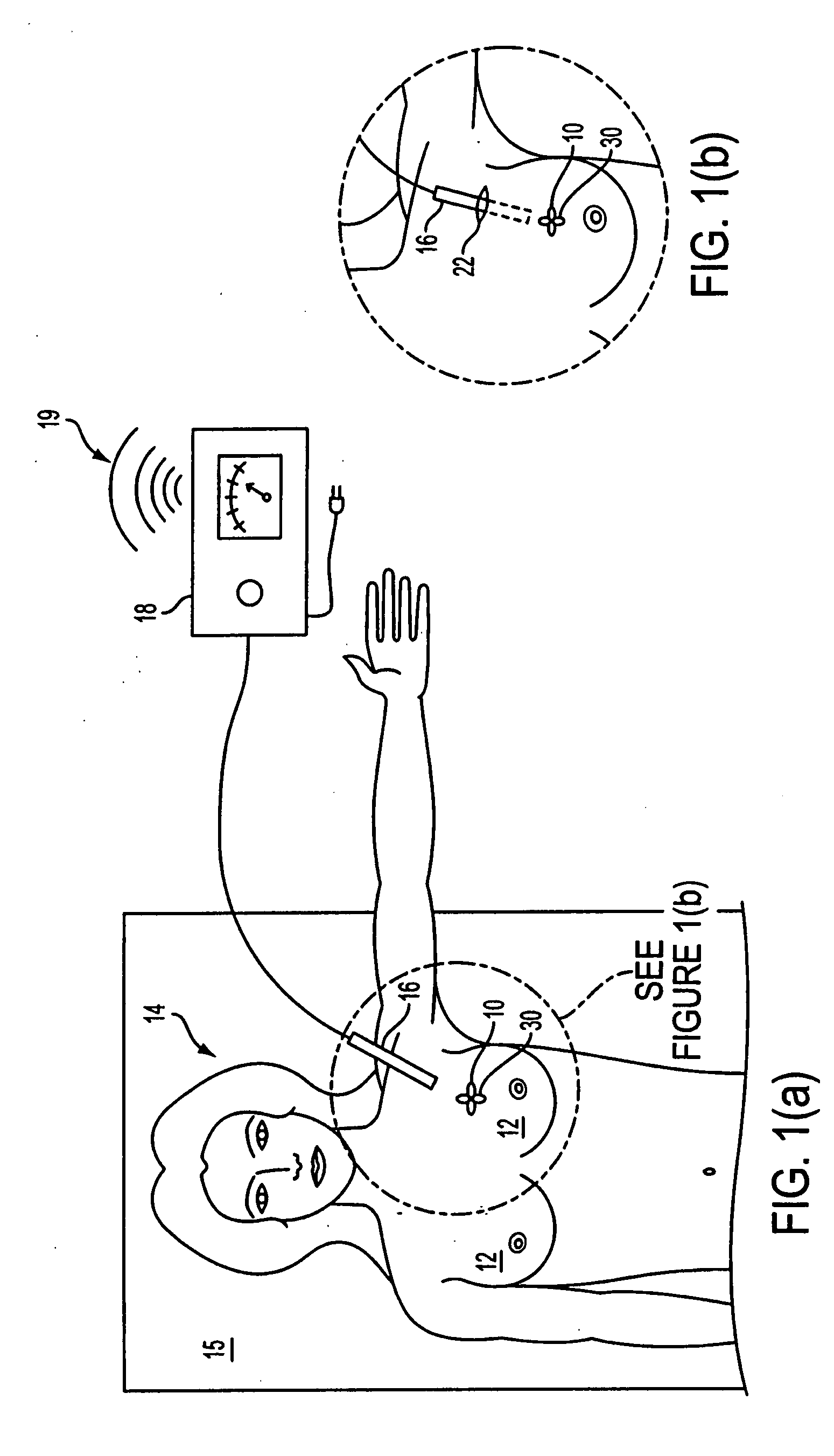 Tissue Marking Devices and Systems