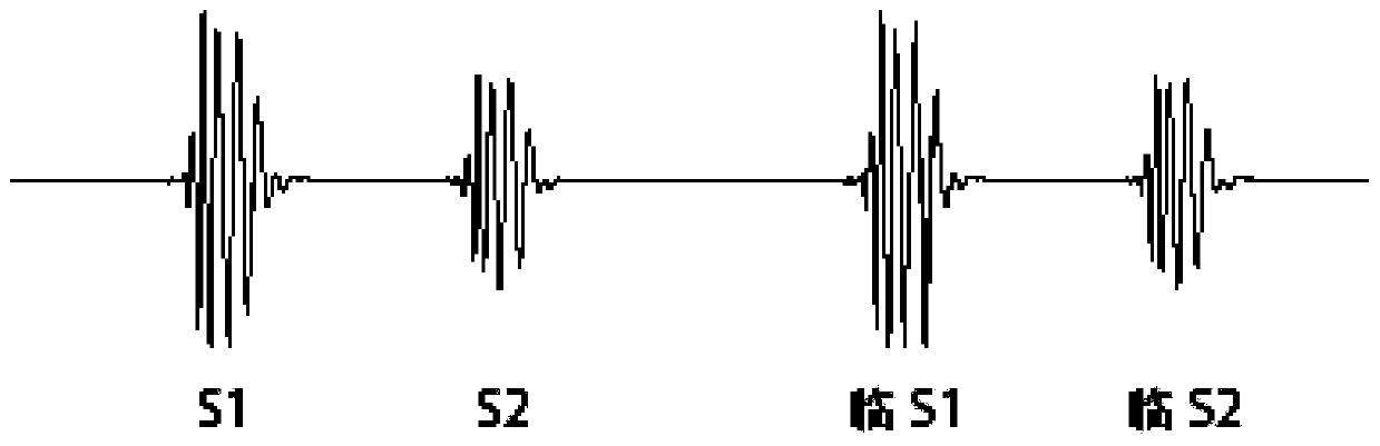 Heart rate calculation method of heart sound signals with part of first heart sounds missing