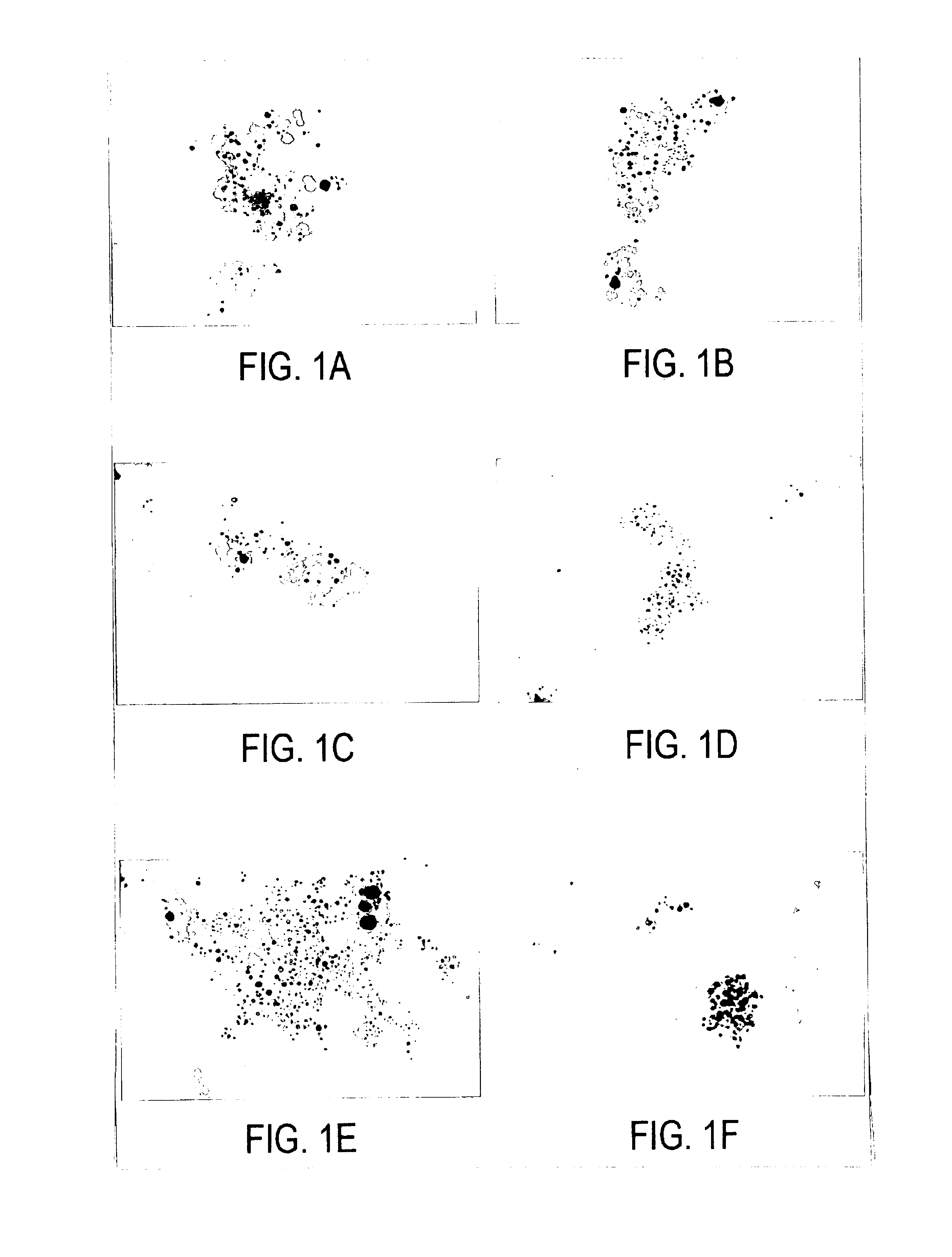 Antimicrobial yarn having nanosilver particles and methods for manufacturing the same
