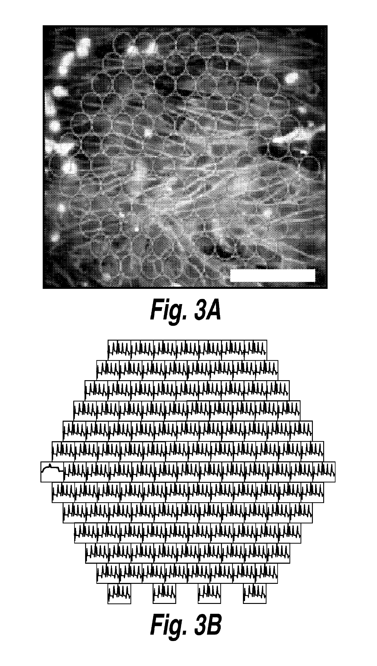 Photosensitive cardiac rhythm modulation systems