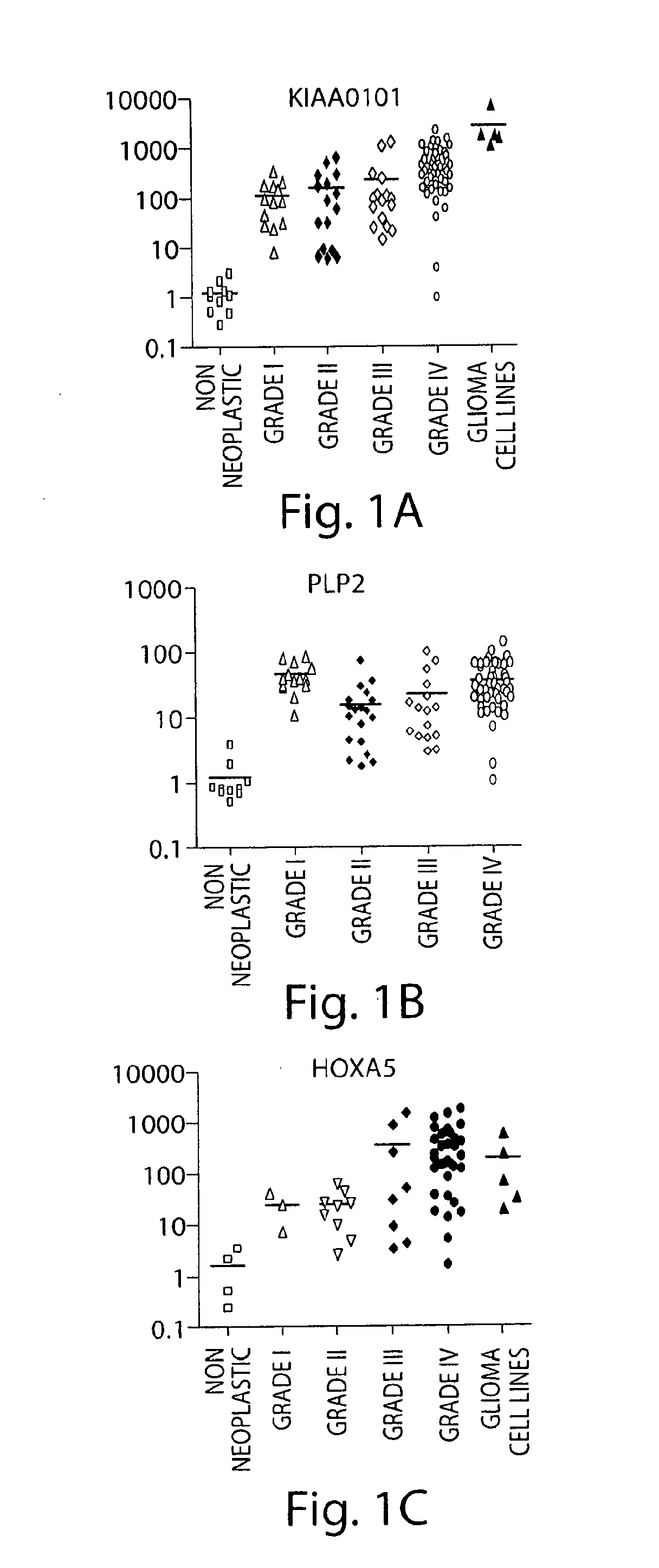 Methods for diagnosing and treating astrocytomas