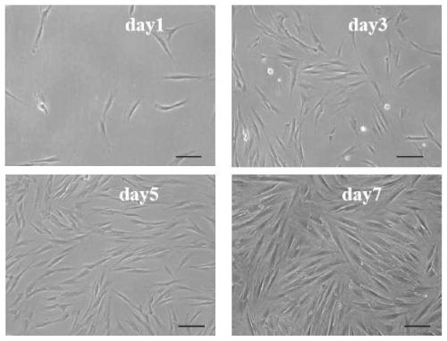 Gingival mesenchymal stem cell exosome preparation and application thereof