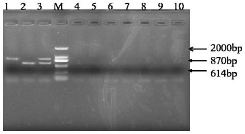 Primer for performing double-PCR early and rapid detection on streptococcus agalactiae and streptococcus iniae as well as application thereof