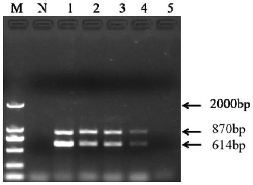 Primer for performing double-PCR early and rapid detection on streptococcus agalactiae and streptococcus iniae as well as application thereof