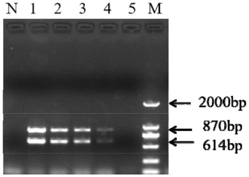 Primer for performing double-PCR early and rapid detection on streptococcus agalactiae and streptococcus iniae as well as application thereof