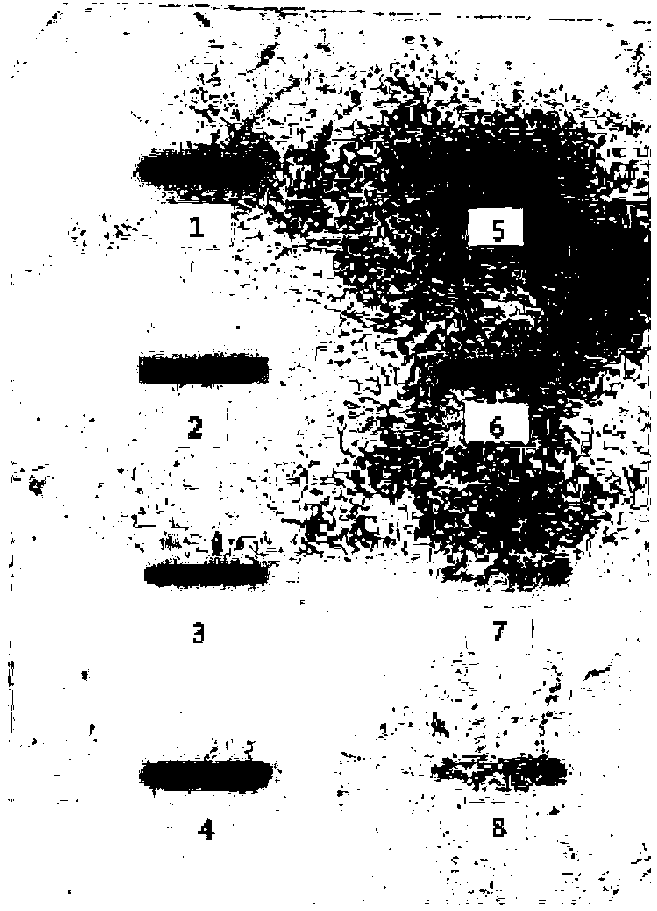 Method for producing HPV31 L1 protein by using Hansenula polymorpha expression system