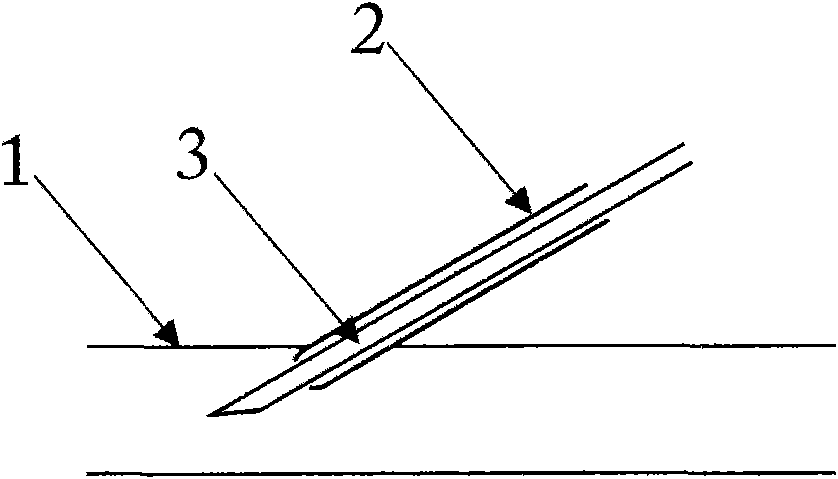 Arteriovenous puncture needle with novel structure and functions