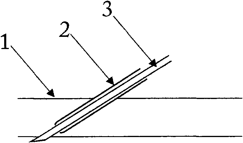 Arteriovenous puncture needle with novel structure and functions