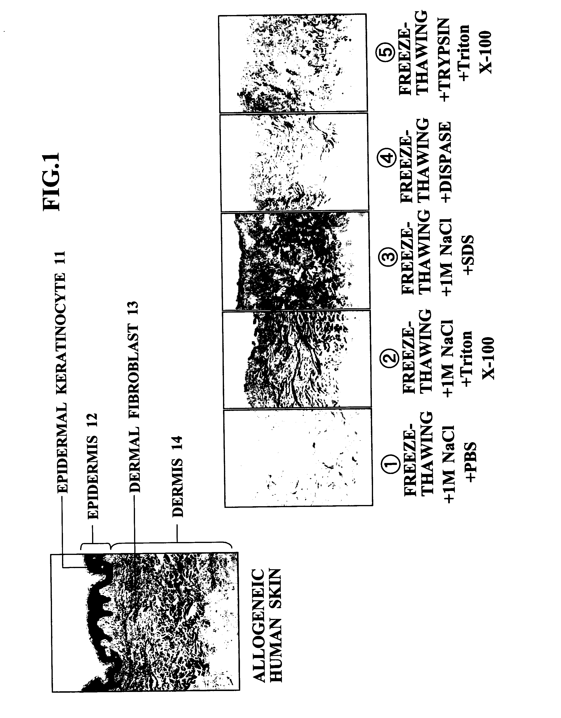 Method of Preparing Isolated Cell-Free Skin, Cell-Free Dermal Matrix, Method of Producing the Same and Composite Cultured Skin with The Use of the Cell-Free Dermal Matrix