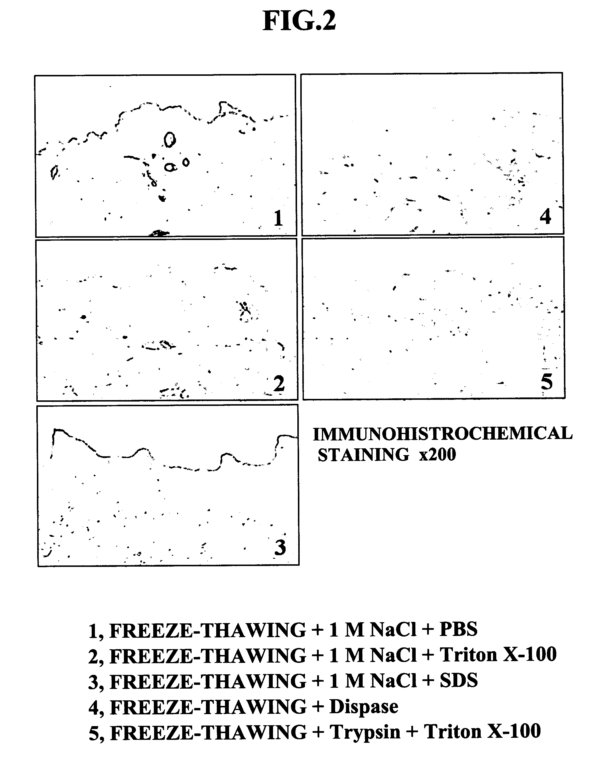 Method of Preparing Isolated Cell-Free Skin, Cell-Free Dermal Matrix, Method of Producing the Same and Composite Cultured Skin with The Use of the Cell-Free Dermal Matrix
