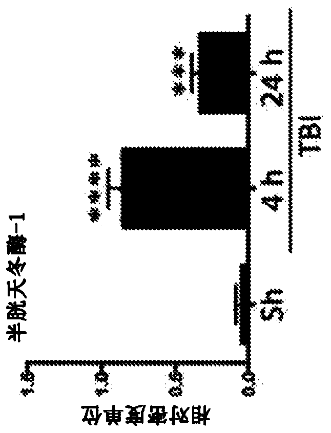 Method for modulating inflammasome activity and inflammation in the lung