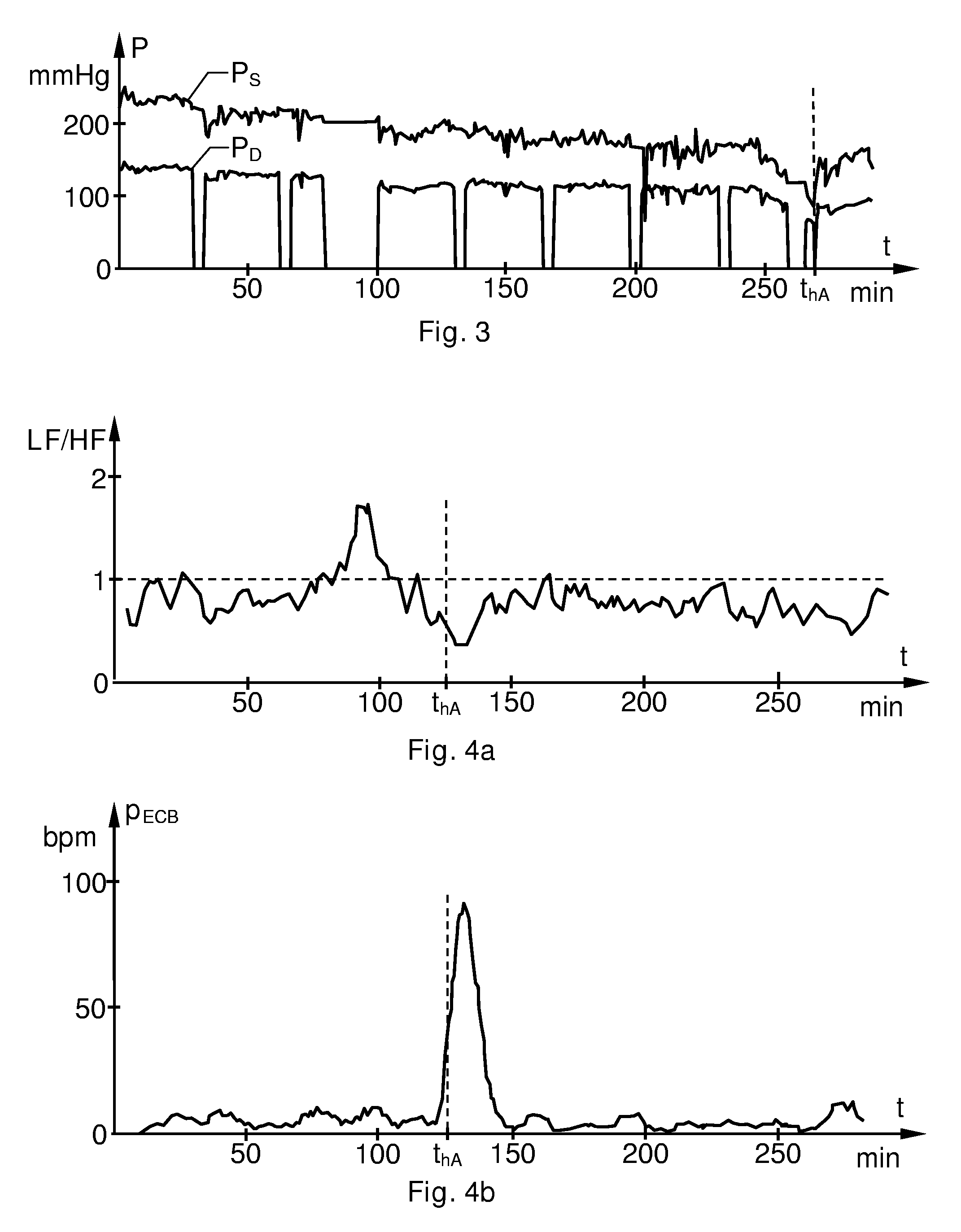 Detection of drastic blood pressure changes