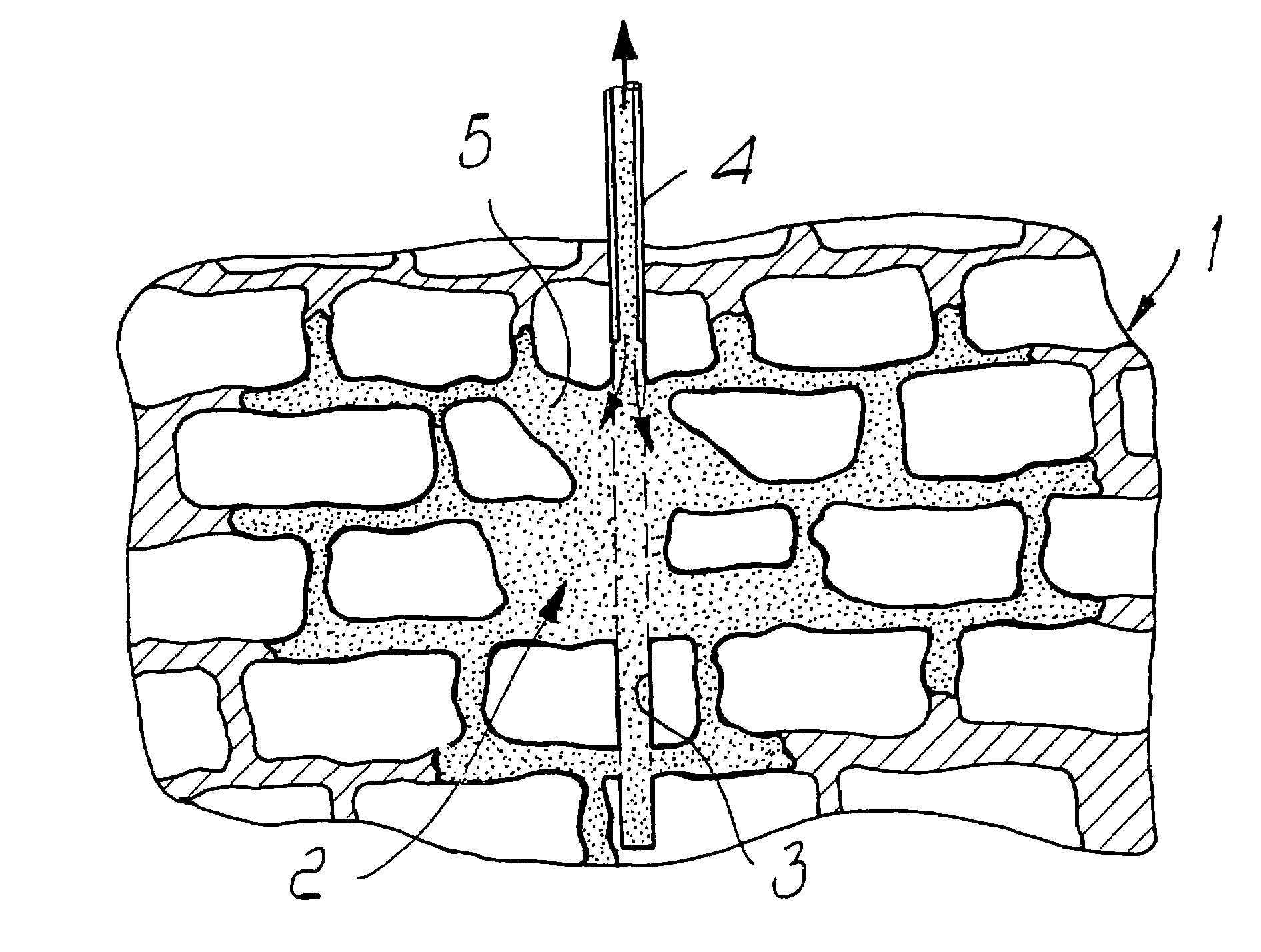 Method for repairing, waterproofing, insulating, reinforcing, restoring of wall systems