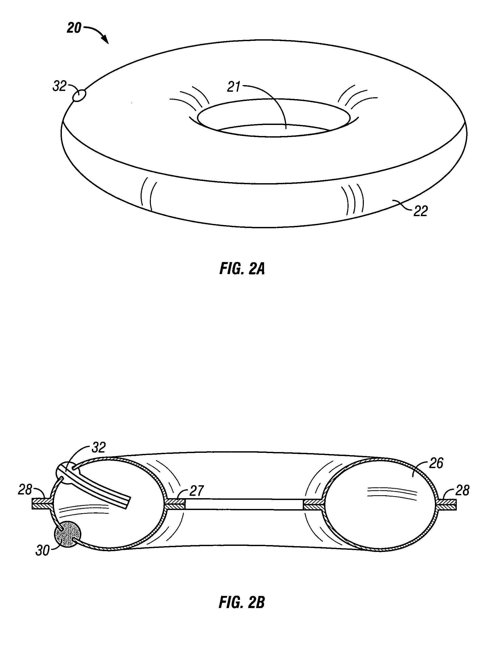 Overweight control apparatuses for insertion into the stomach