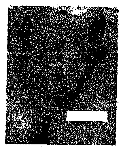 Compounds or agents that inhibit and induce the formation of focal microvessel dilatations