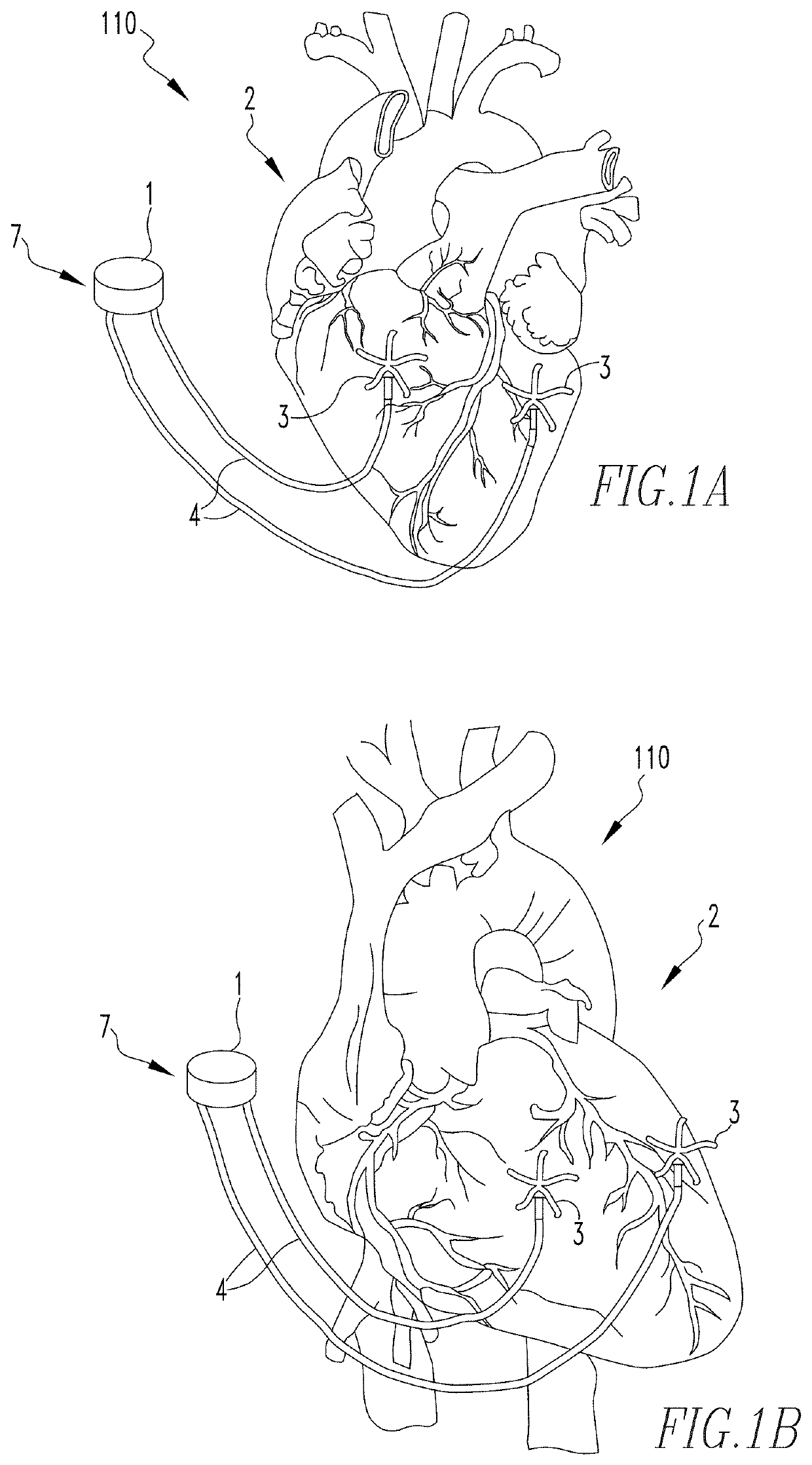 Method and apparatus for monitoring a patient